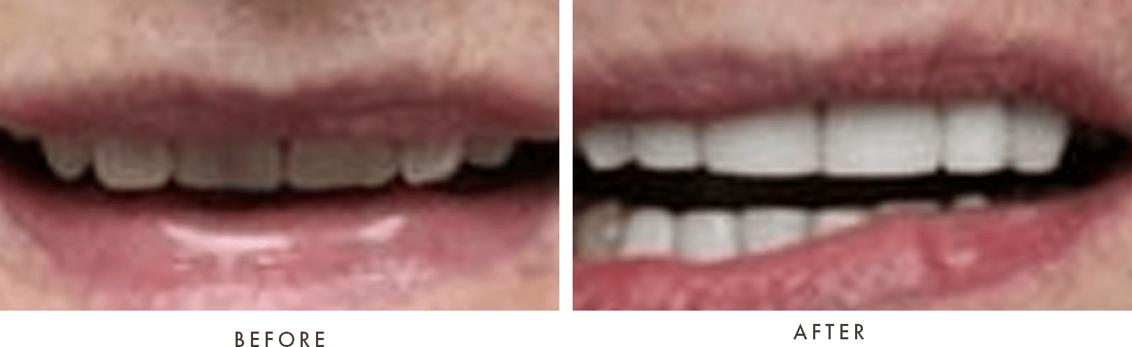 case 17 combined before and after old website