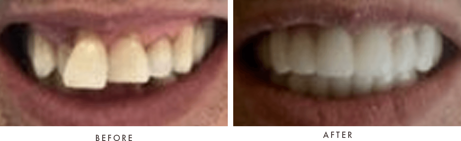 case 18 combined before and after old website