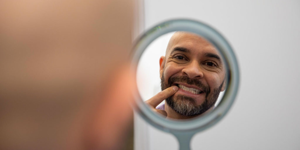 dental implant patient showing implants in mirror