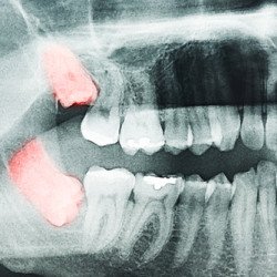 Xray example model